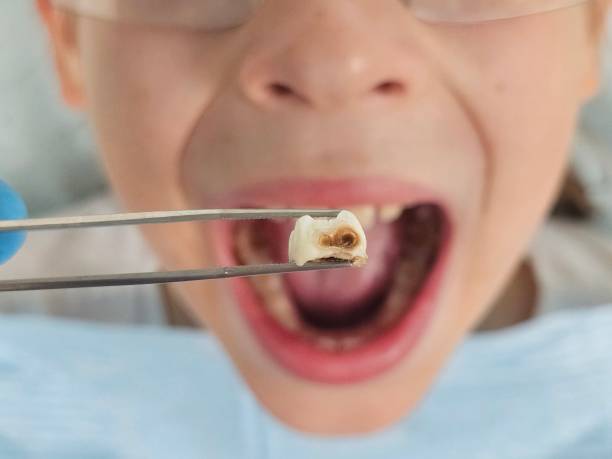 Best Knocked-Out Tooth Emergency  in Monroe, MI